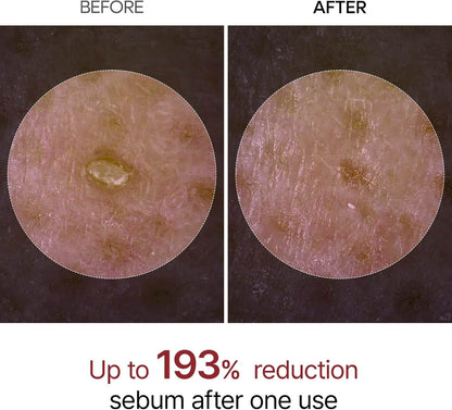 Dr.Melaxin Peel Shot Exfoliating White & Black Rice Ampoule Essence